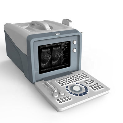 quality  Ultrasound laptop diagnostic ultrasound machine /black and white ultrasound scanner with 15 inch LCD screen factory