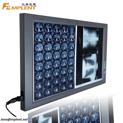 quality  Super Bright Digital Dual General Film Medical Negatoscope LED X Ray Viewer factory