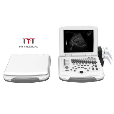 Portable ABS Digital Laptop Color Doppler Ultrasound Machine