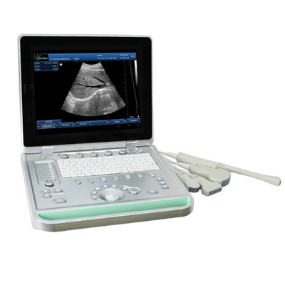 MCB-SS-9 Fully Function Laptop Digital Ultrasound Scanner 3D Image