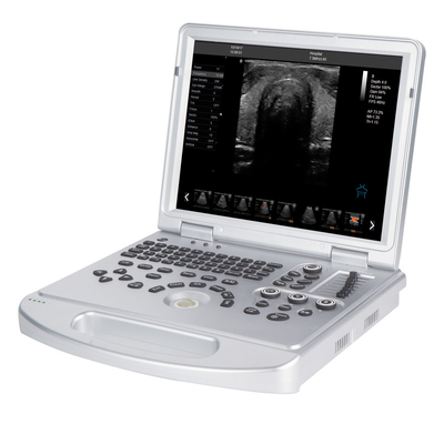 3D/4D/5D Pro Best Function RC-L5 Color Laptop 3d/4d Ultrasound Machine System