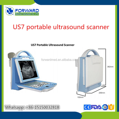 DP 10 Laptop Ultrasound Machine 10.4inch Digital Color LCD Cheaper Than Mindray Ultrasound