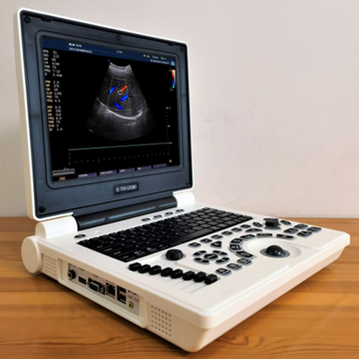 12 Inch Portable Eco Plastic Laptop Color Doppler Ultrasound Scanner