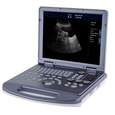 Full Metal High Quality Laptop Digital B/W 2D Ultrasound Machine With CE ISO13485